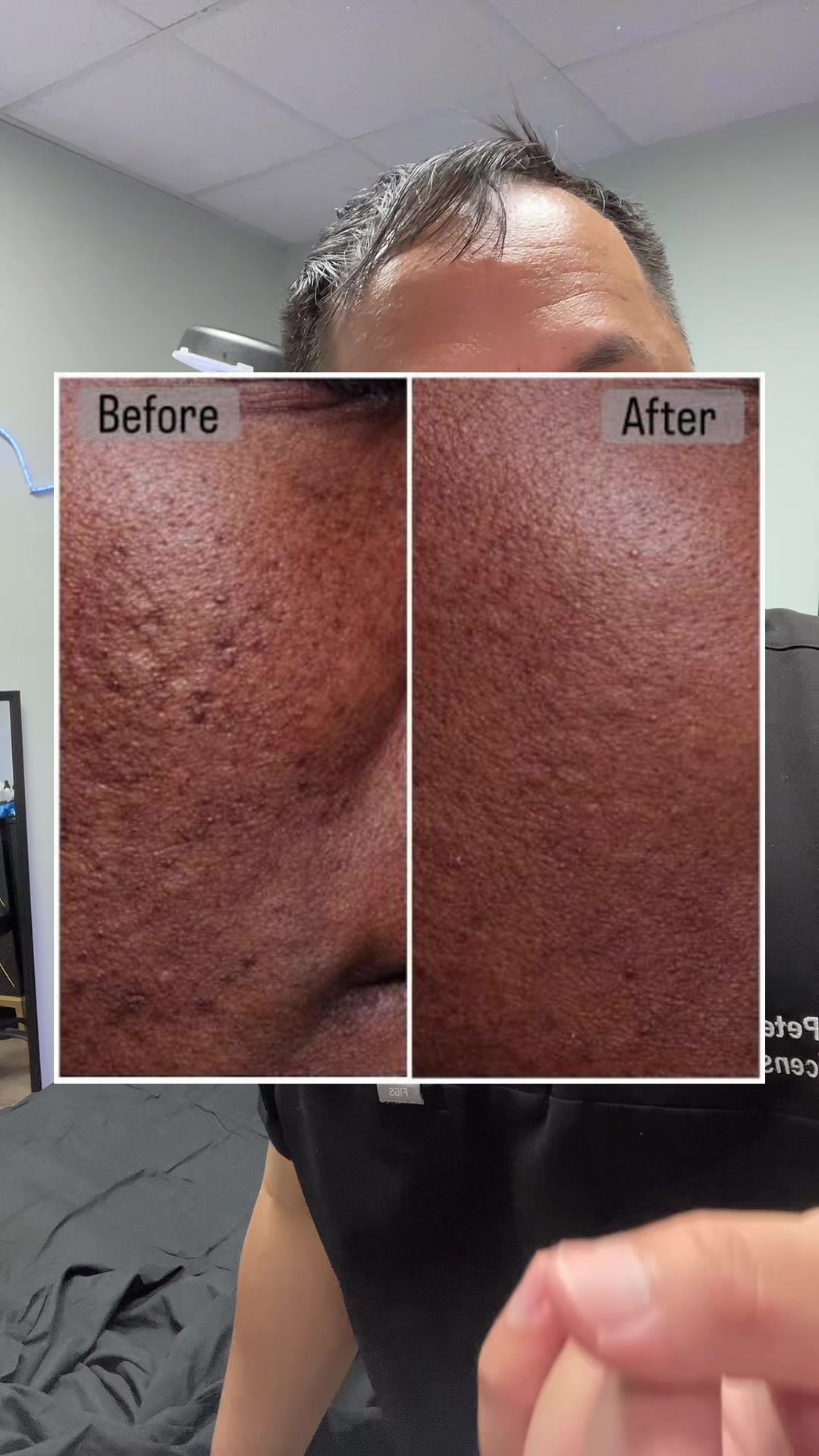 @EstheticianPete