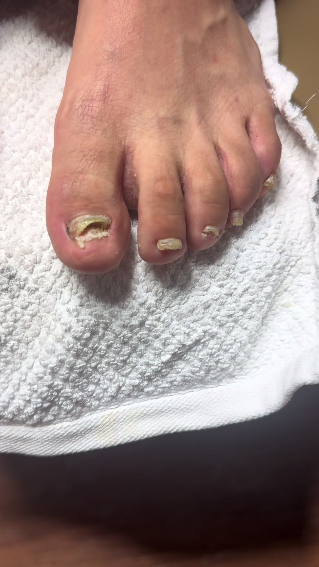 @ToesbyKoki
