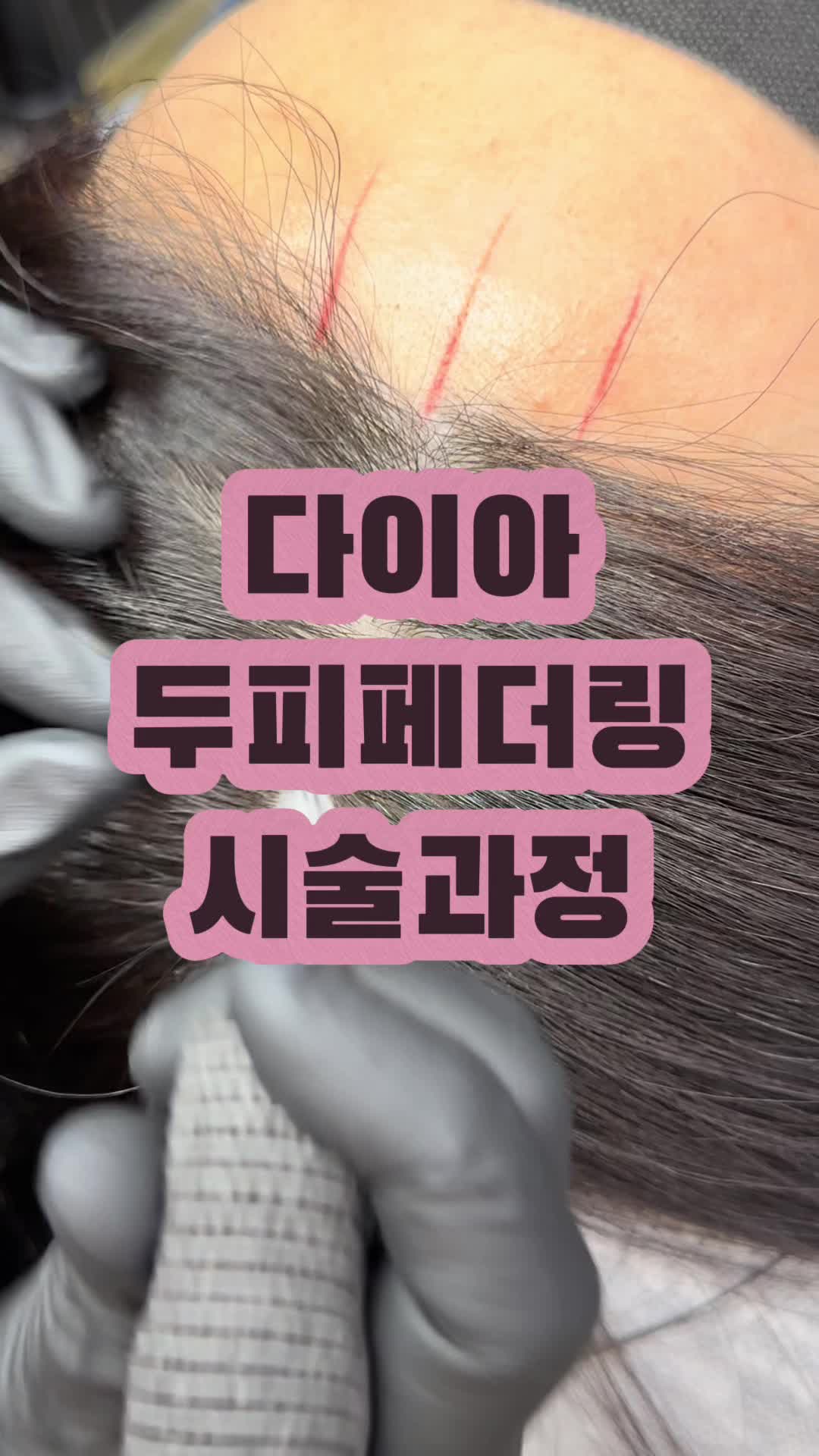 @엘리