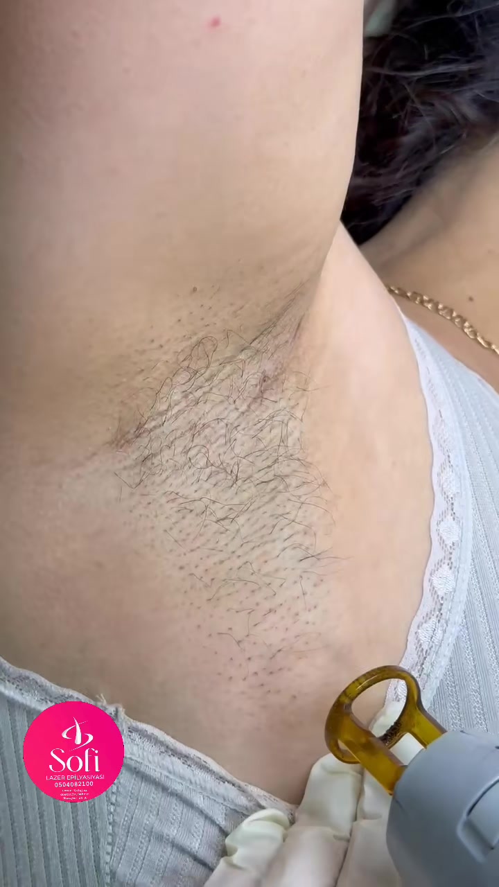 @𝑺𝒐𝒇𝒊 𝑳𝒂𝒛𝒆𝒓✨️