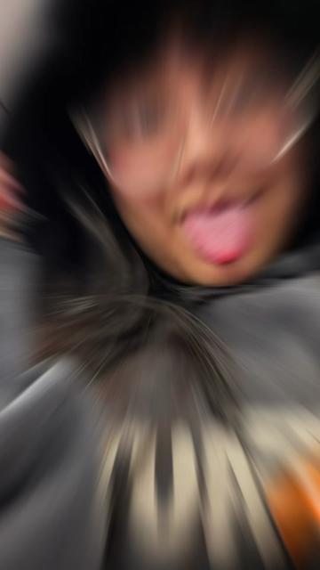 @๐ฟ๐๐โ๏ธ๐ธ๐๐ถ๐๐๐๐๐ฟ๐ฎ