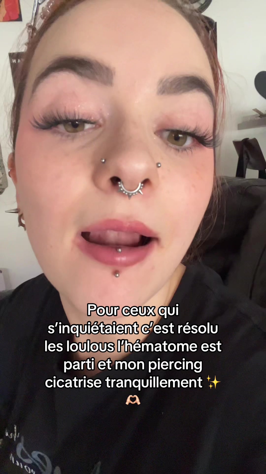 @Lucyle Caso