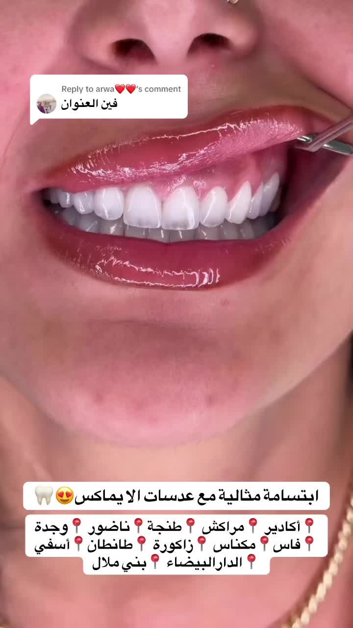@brightsmileee1