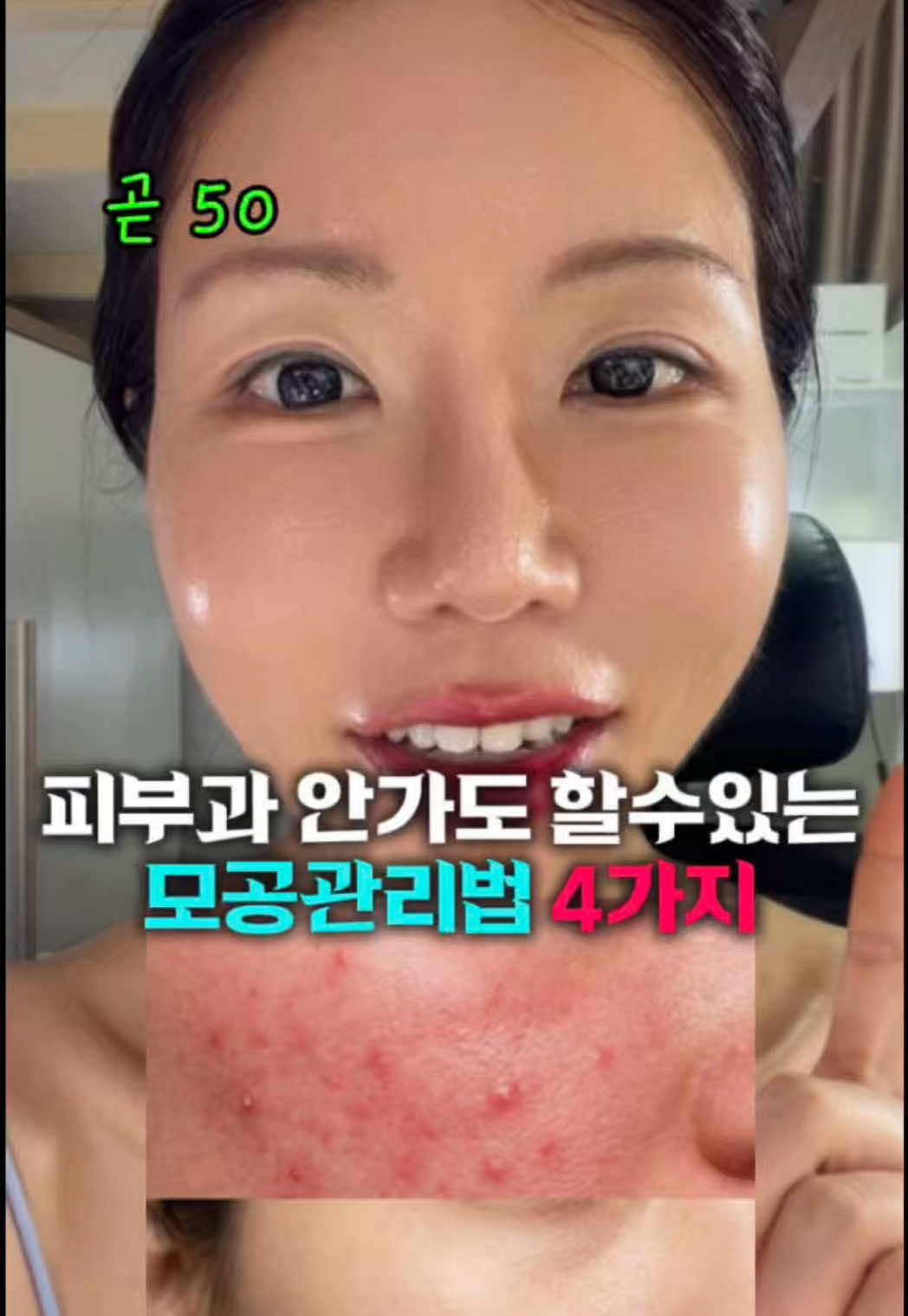 @지나스 GINAS