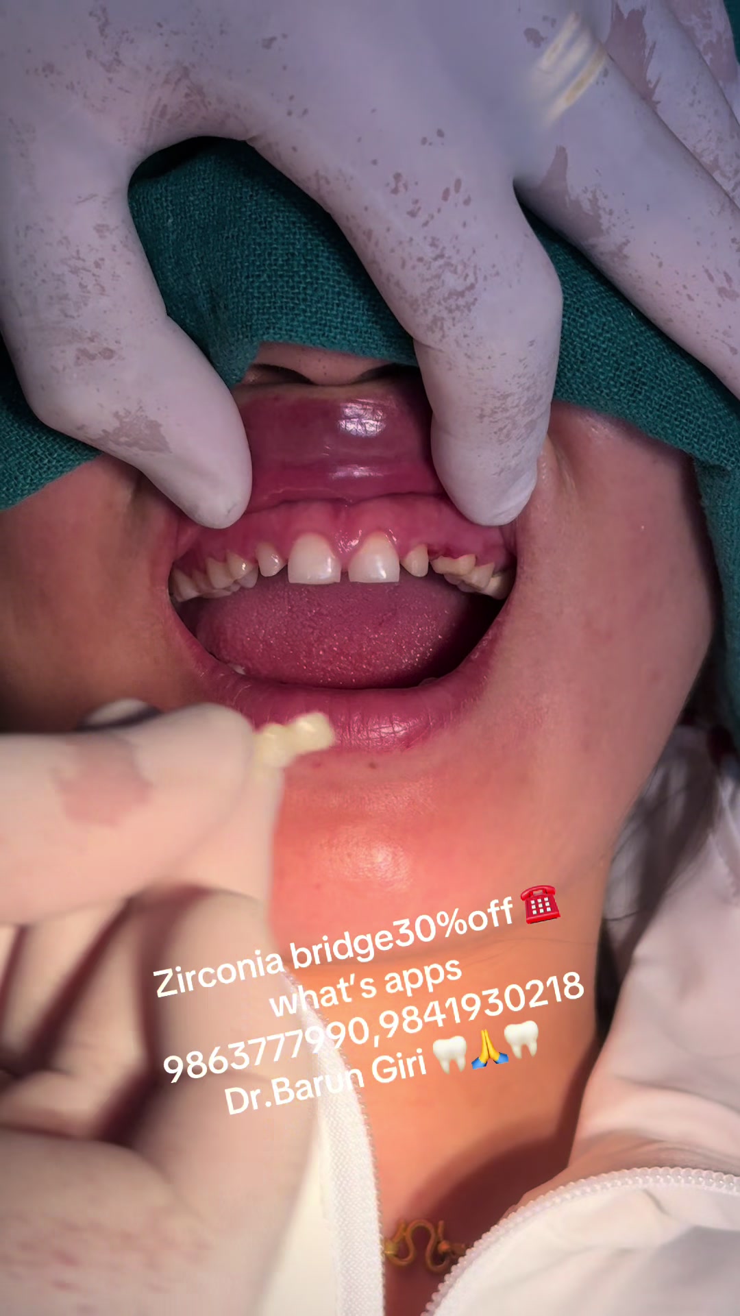 @Unique dental clinic Chabahil