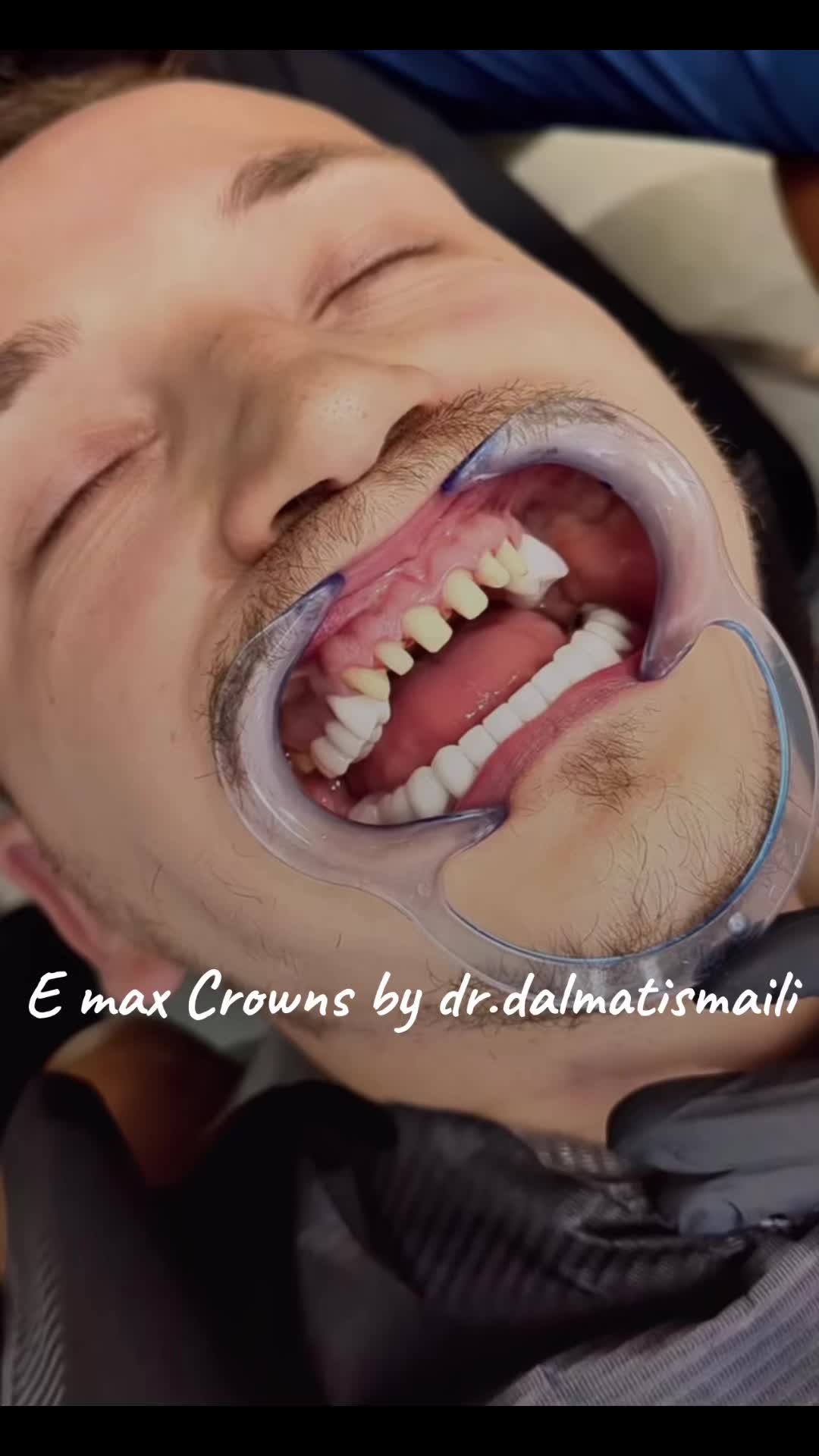 @Dr. Dalmat Ismaili
