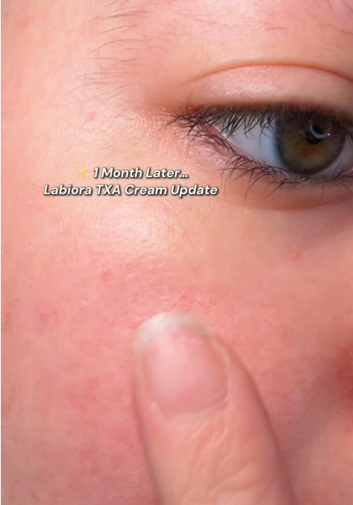 @Katie | Olive Skin + Beauty