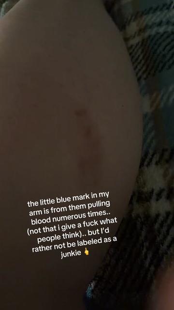 @me🩶