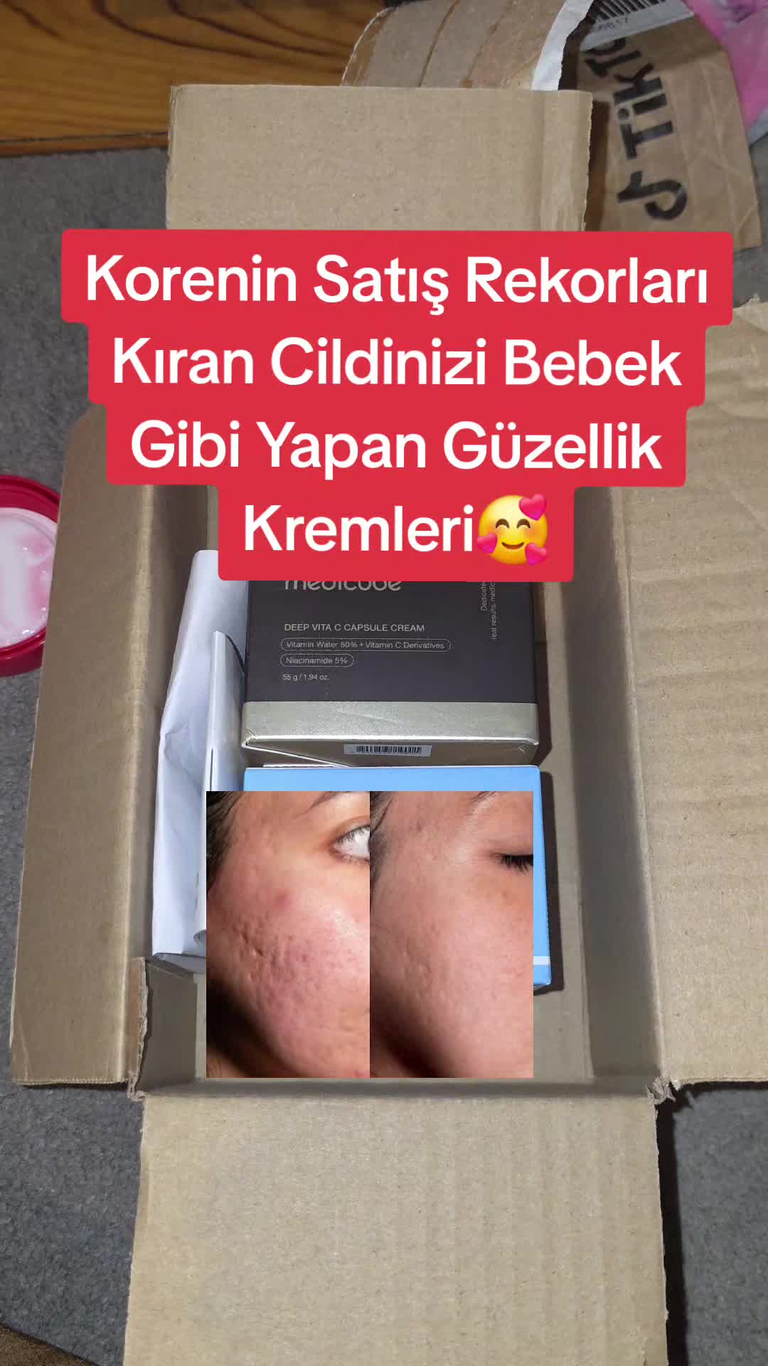 @Gurbetana27