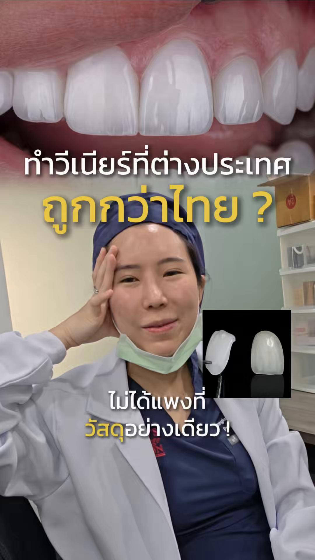 @หมอป่องสวยมาก veneer 🦷