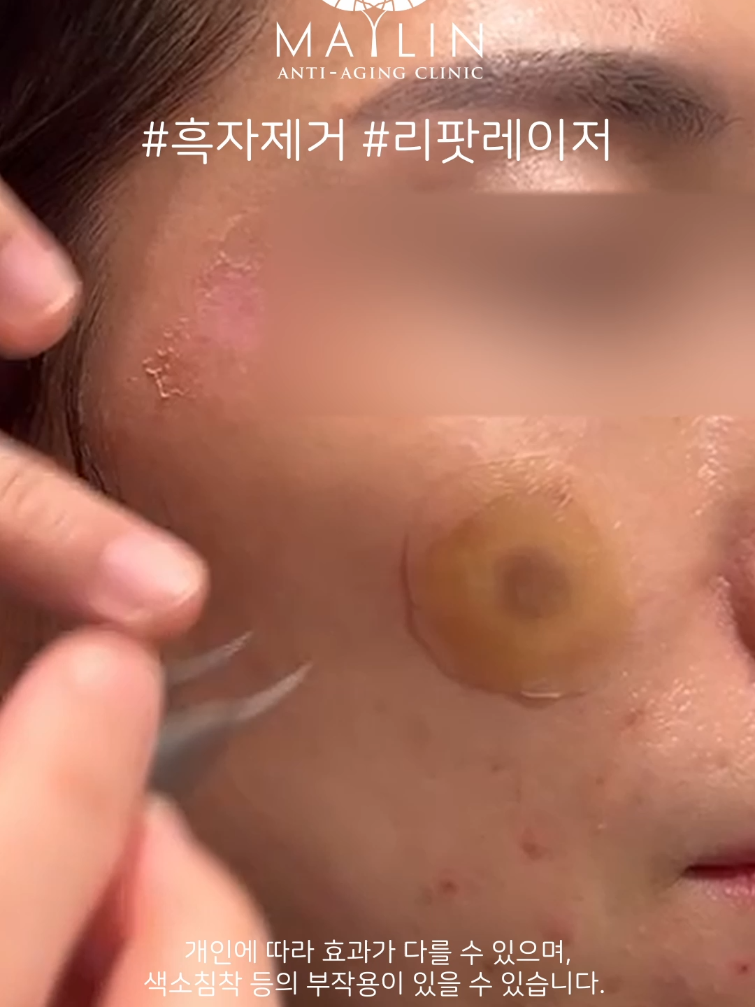 @메이린의원대구점