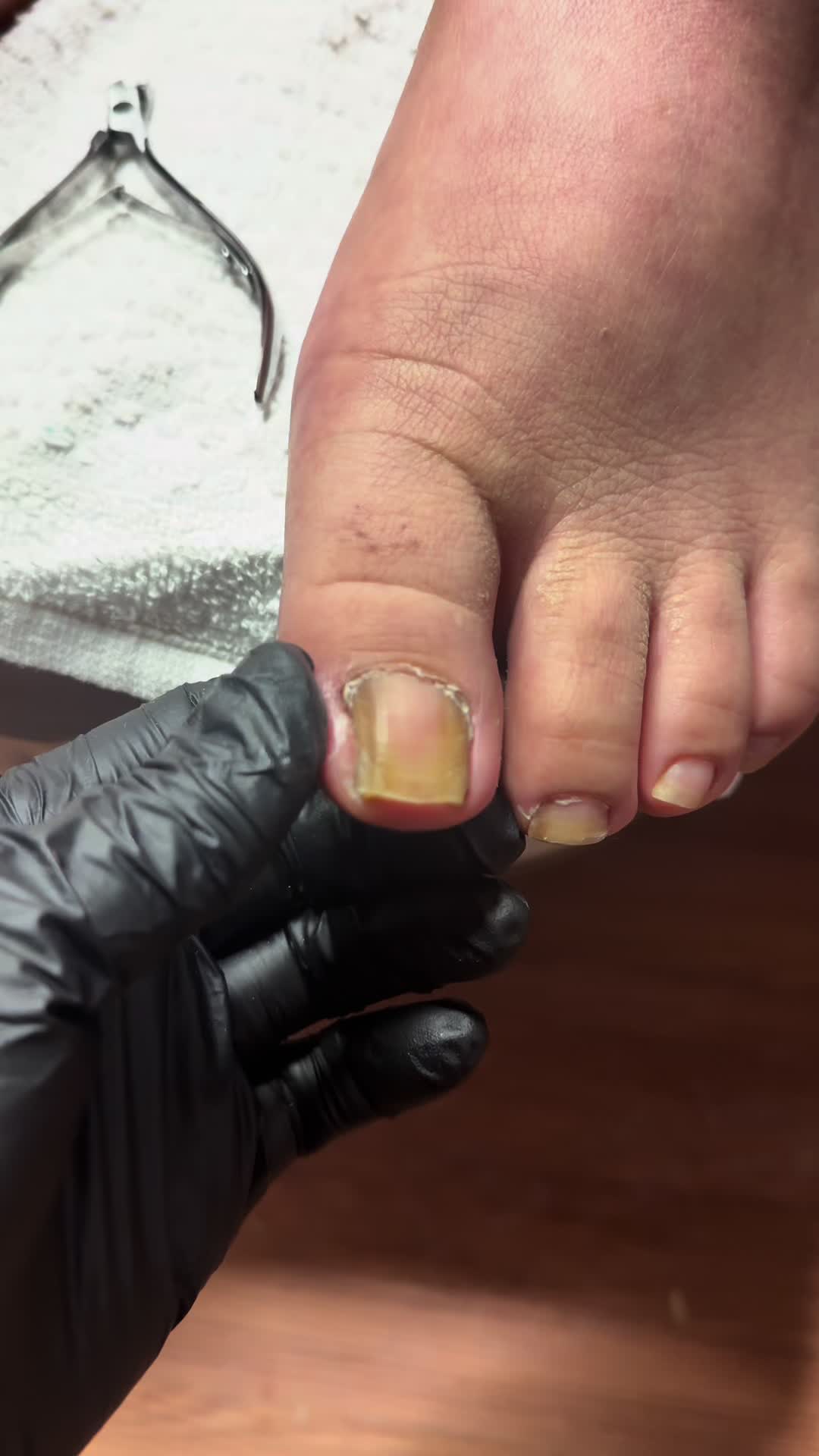 @ToesbyKoki