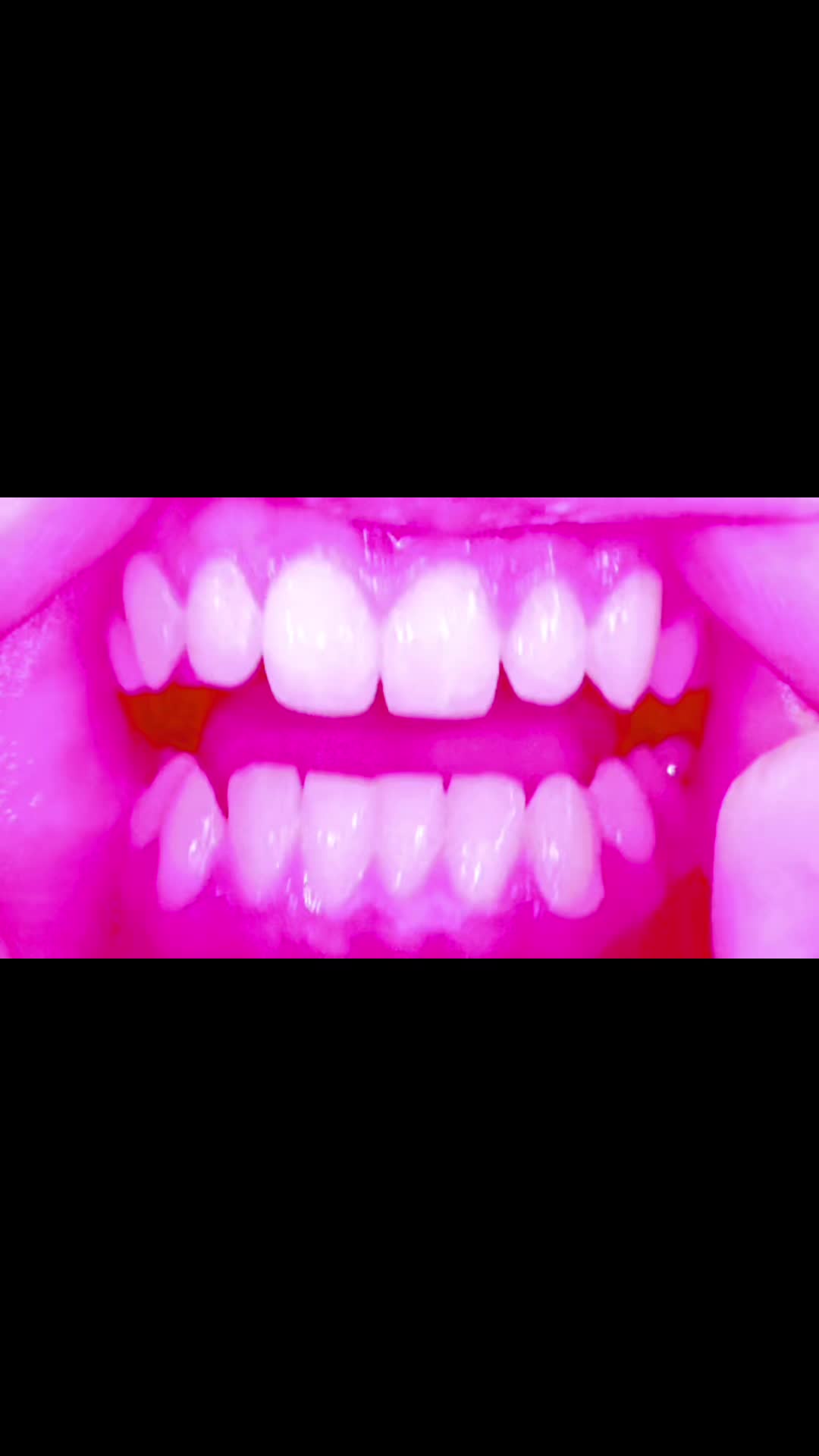 @•๐•