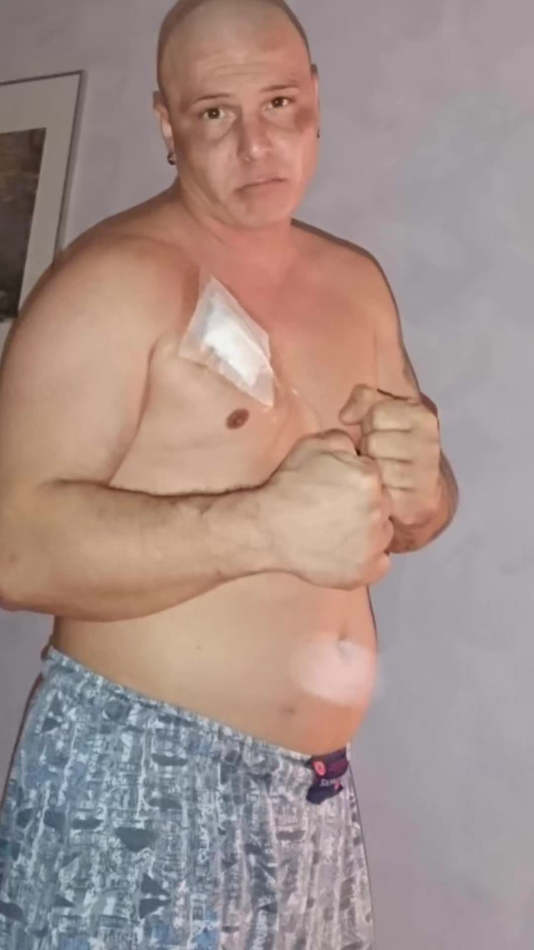 @Spucke37