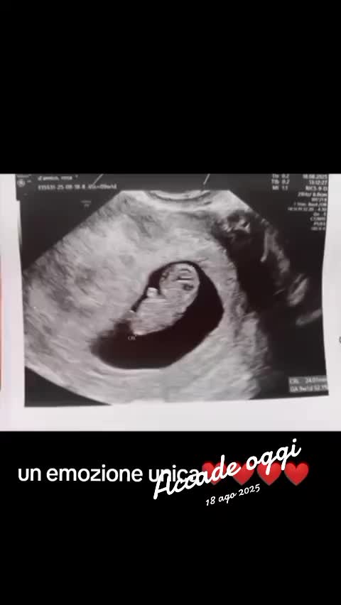@peppeelucia
