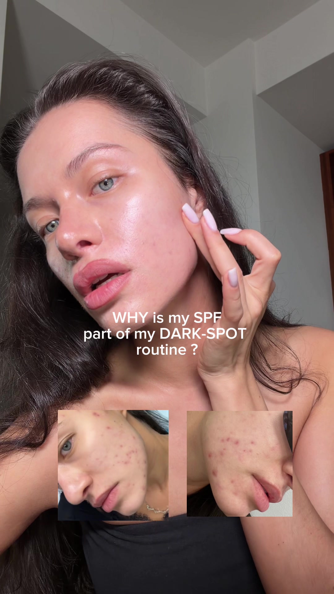 @Mishka Dii