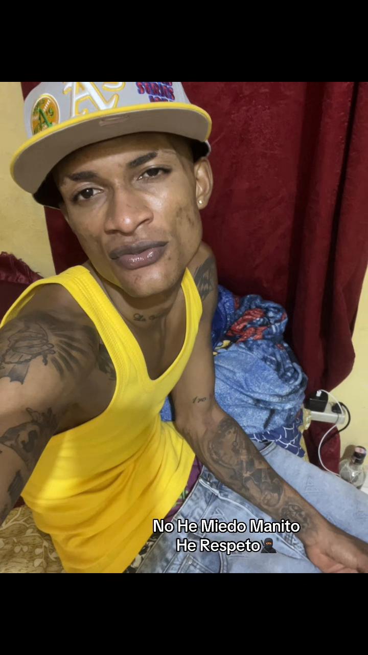 @Elmocho R01