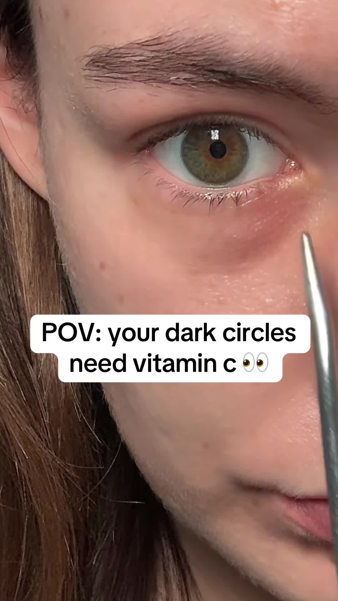 @watermelonsugarskin