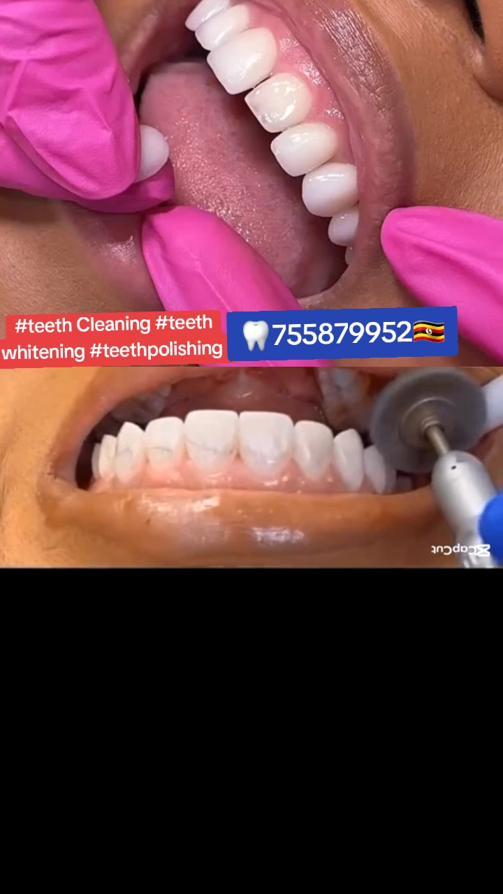 @Allianz Dental studio🦷🦷🇺🇬