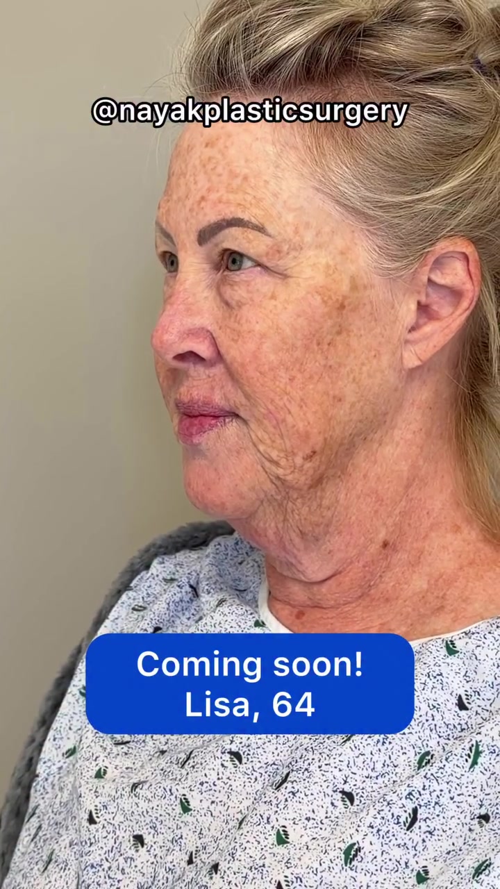 @NayakPlasticSurgery