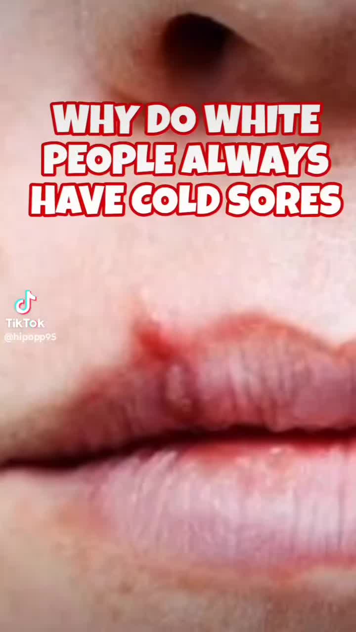 @TUTLEO