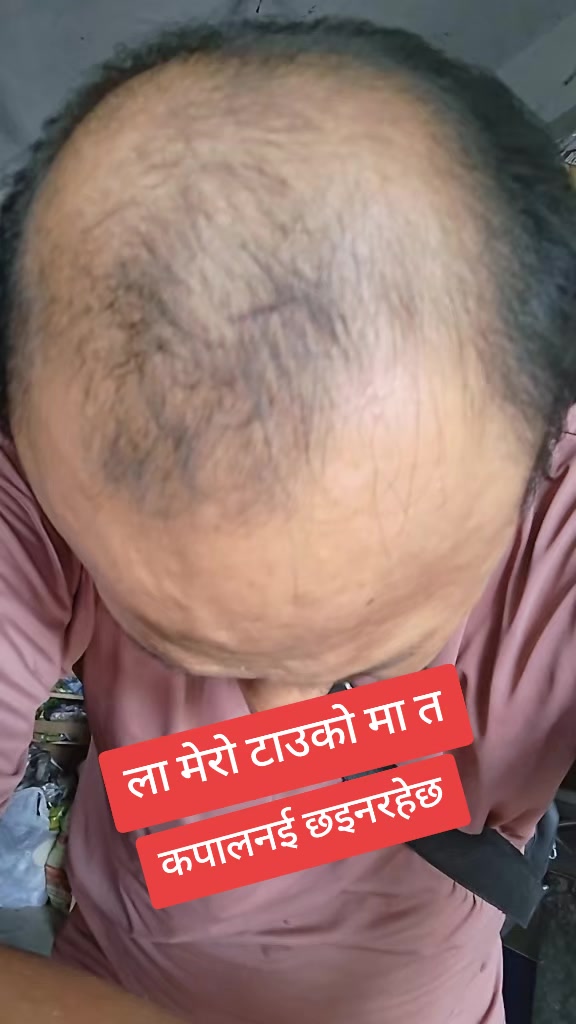 @सरु💞💞💞पुस्प