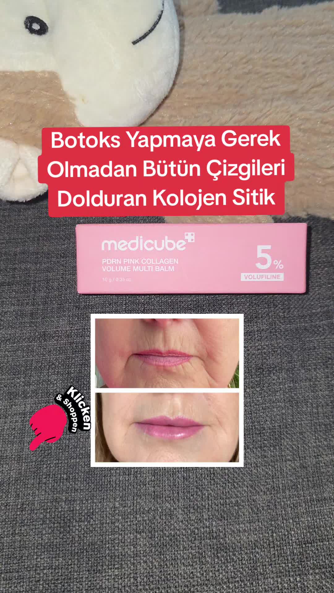 @Gurbetana27