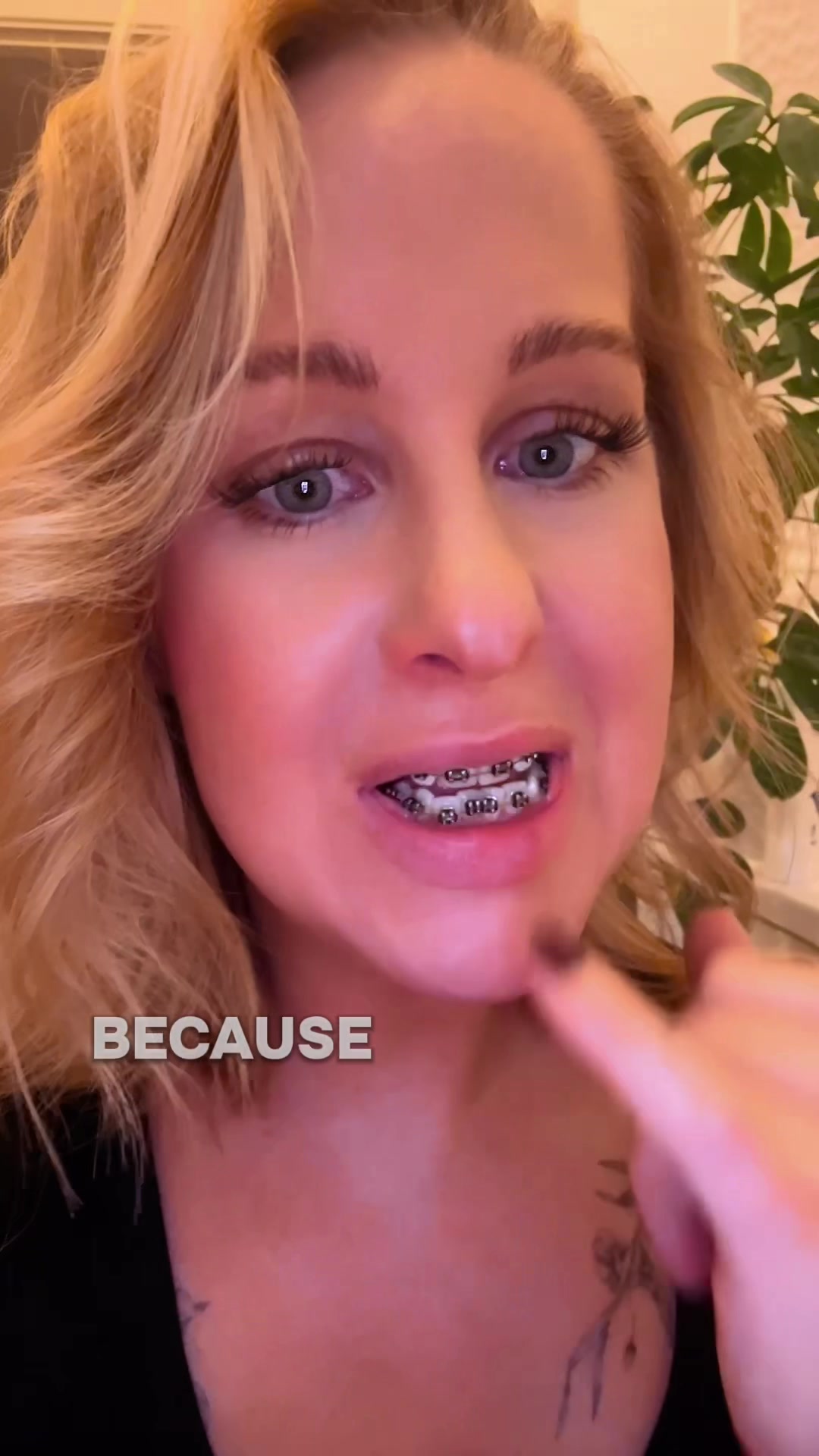 @AdultBraces
