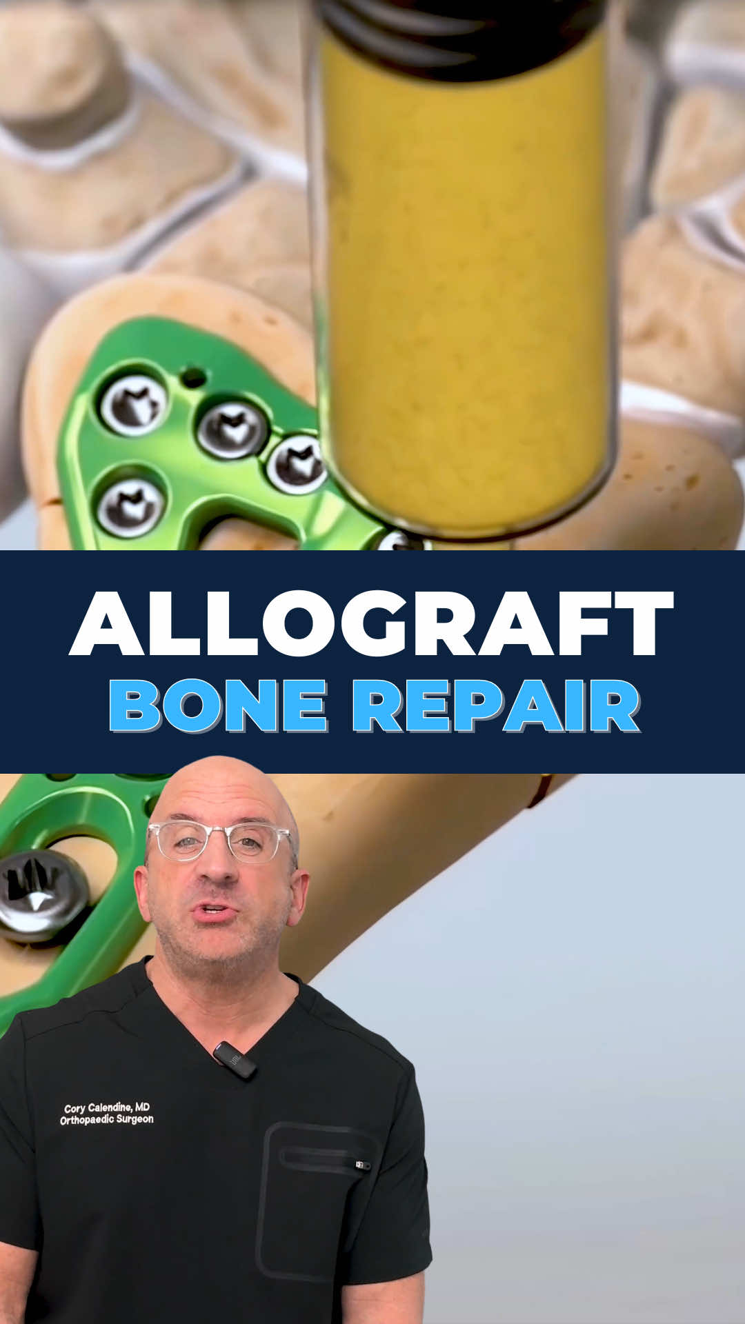 @Bone Doctor - Joint Pain MD