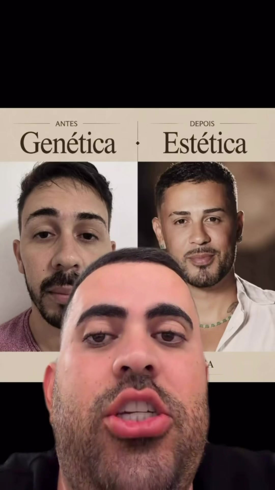 @roninho