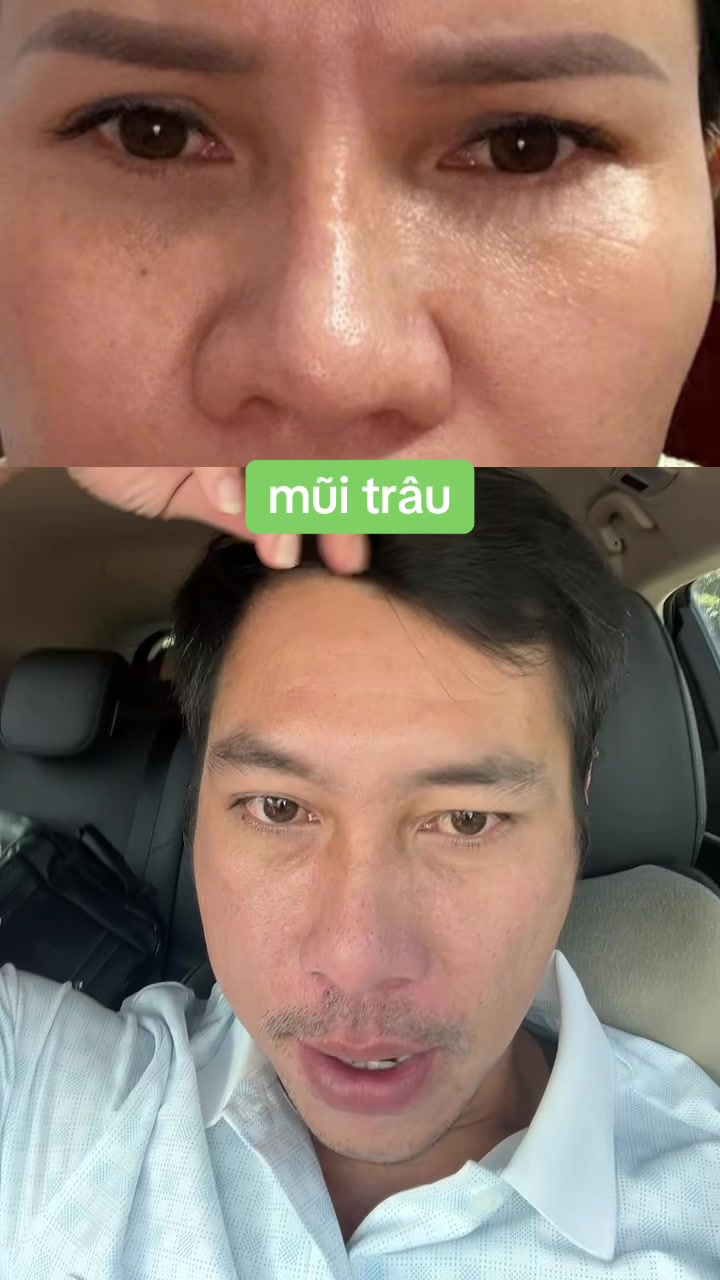 @Tuệ Nhãn ✅