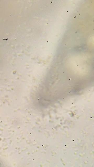 @Smeee❌microscope🏴󠁧󠁢󠁥󠁮󠁧󠁿