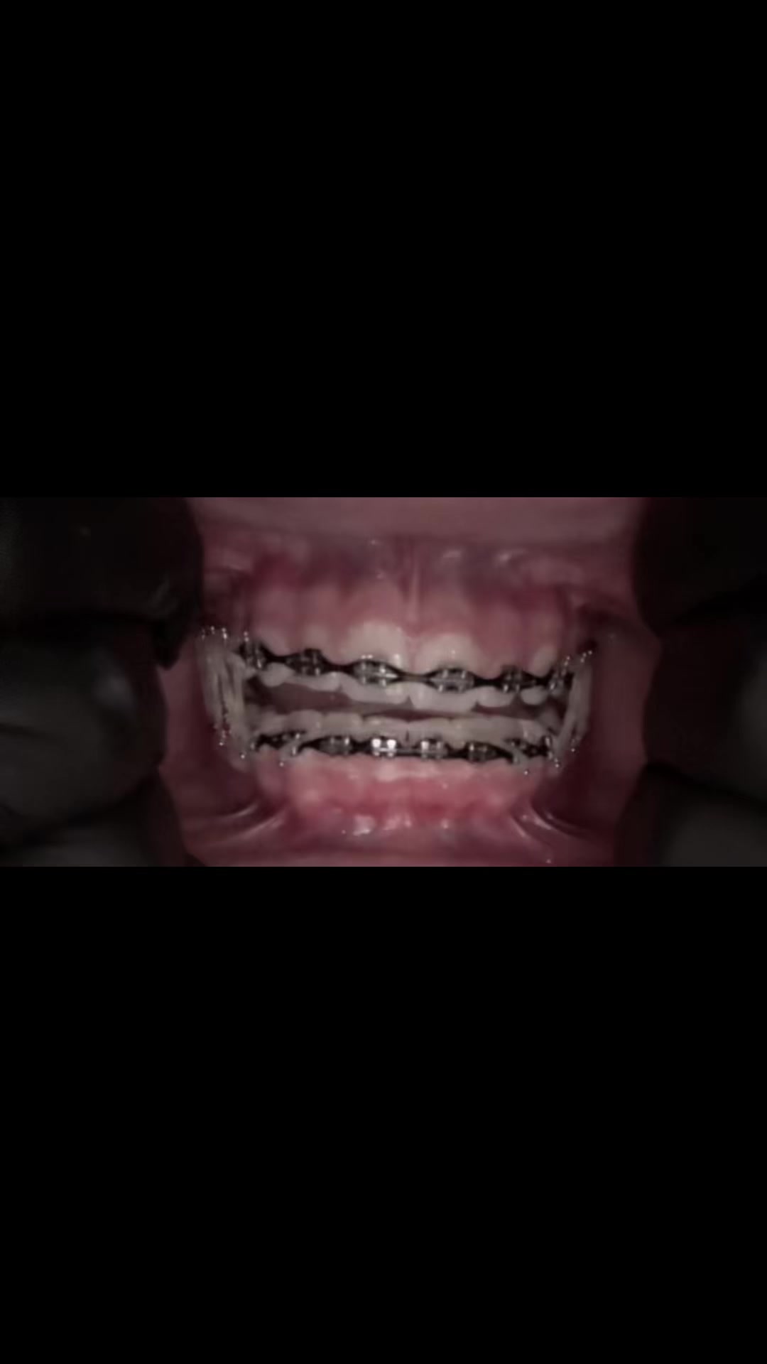 @⭐️//-Asher-//🦷