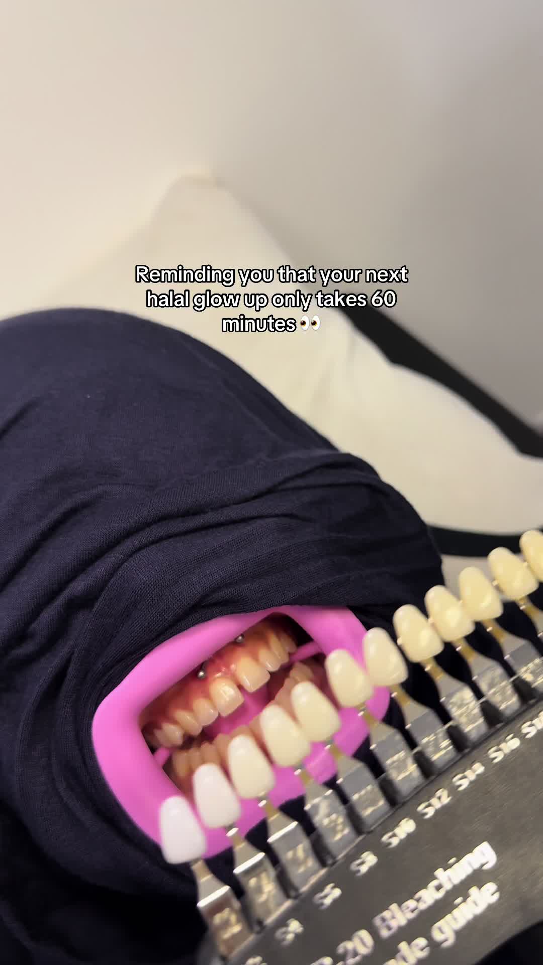 @Halal Teeth Whitening London