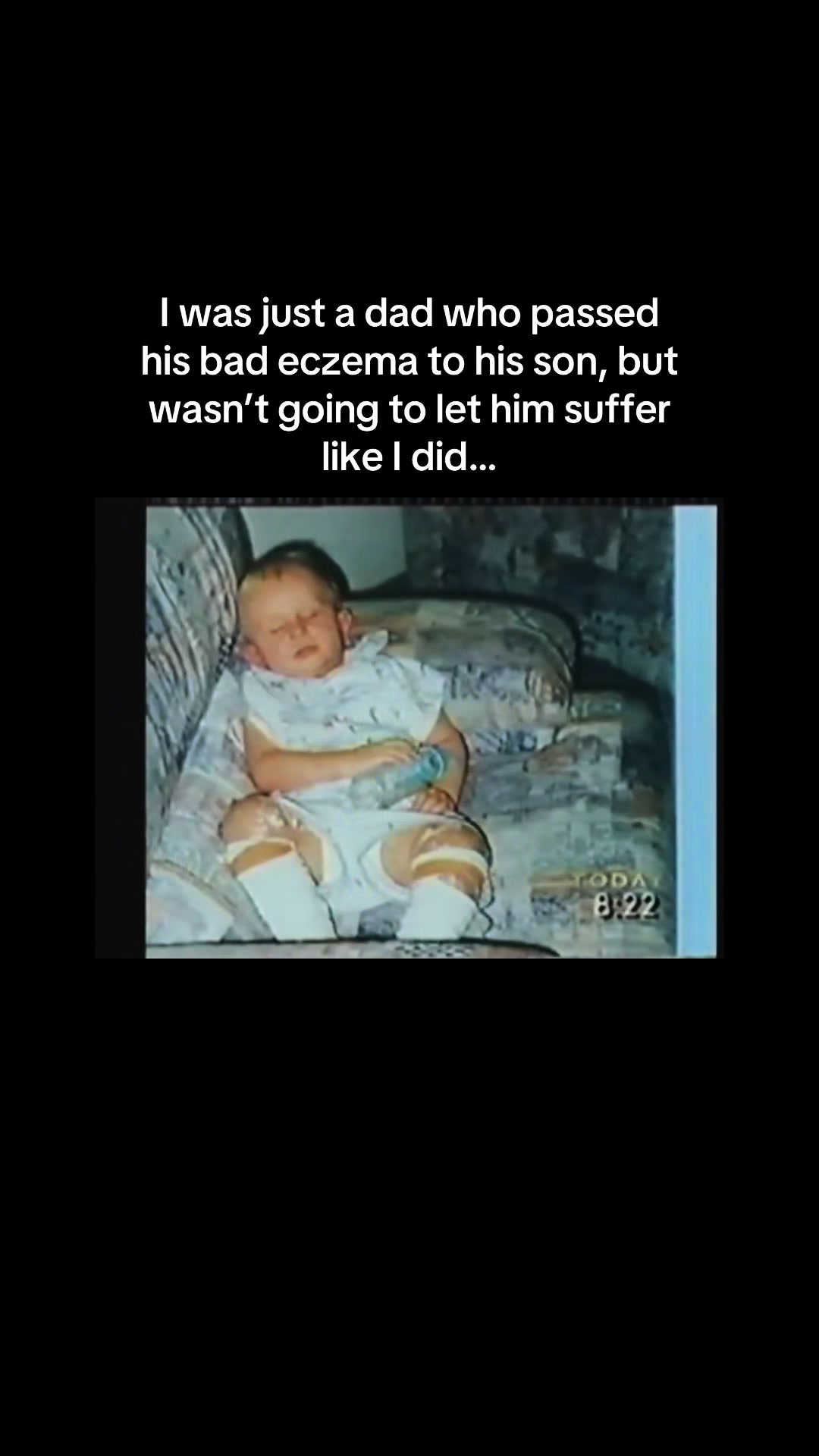 @Eczema Diaries USA & UK