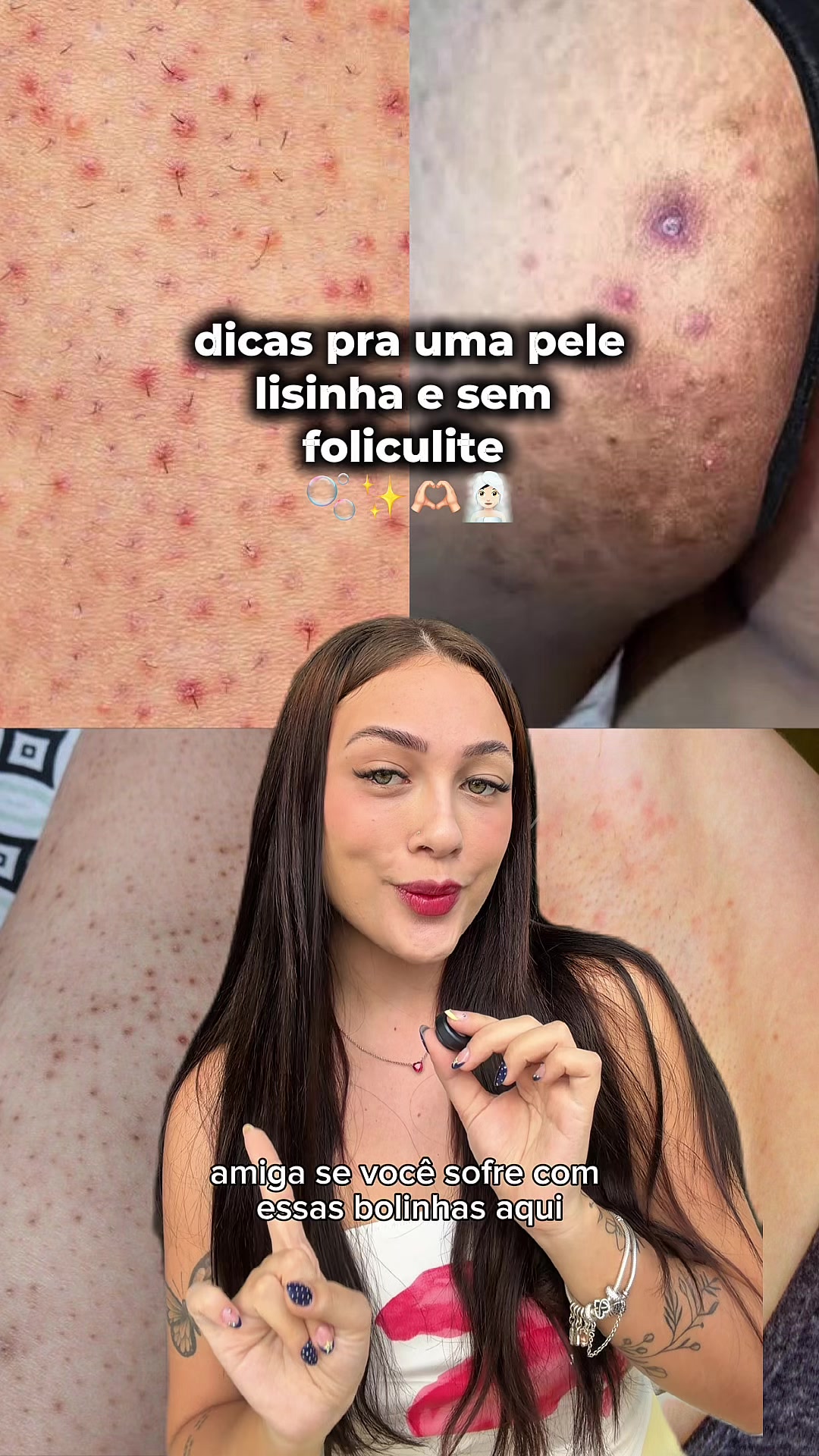 @Bruna Schulz