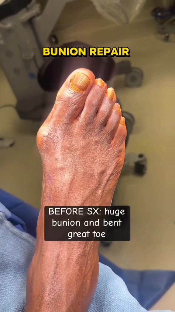 @Deniel Foot and Ankle Center