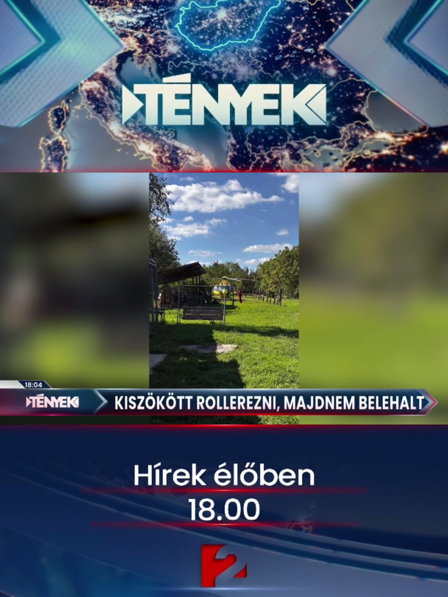 @TV2 T&eacute;nyek