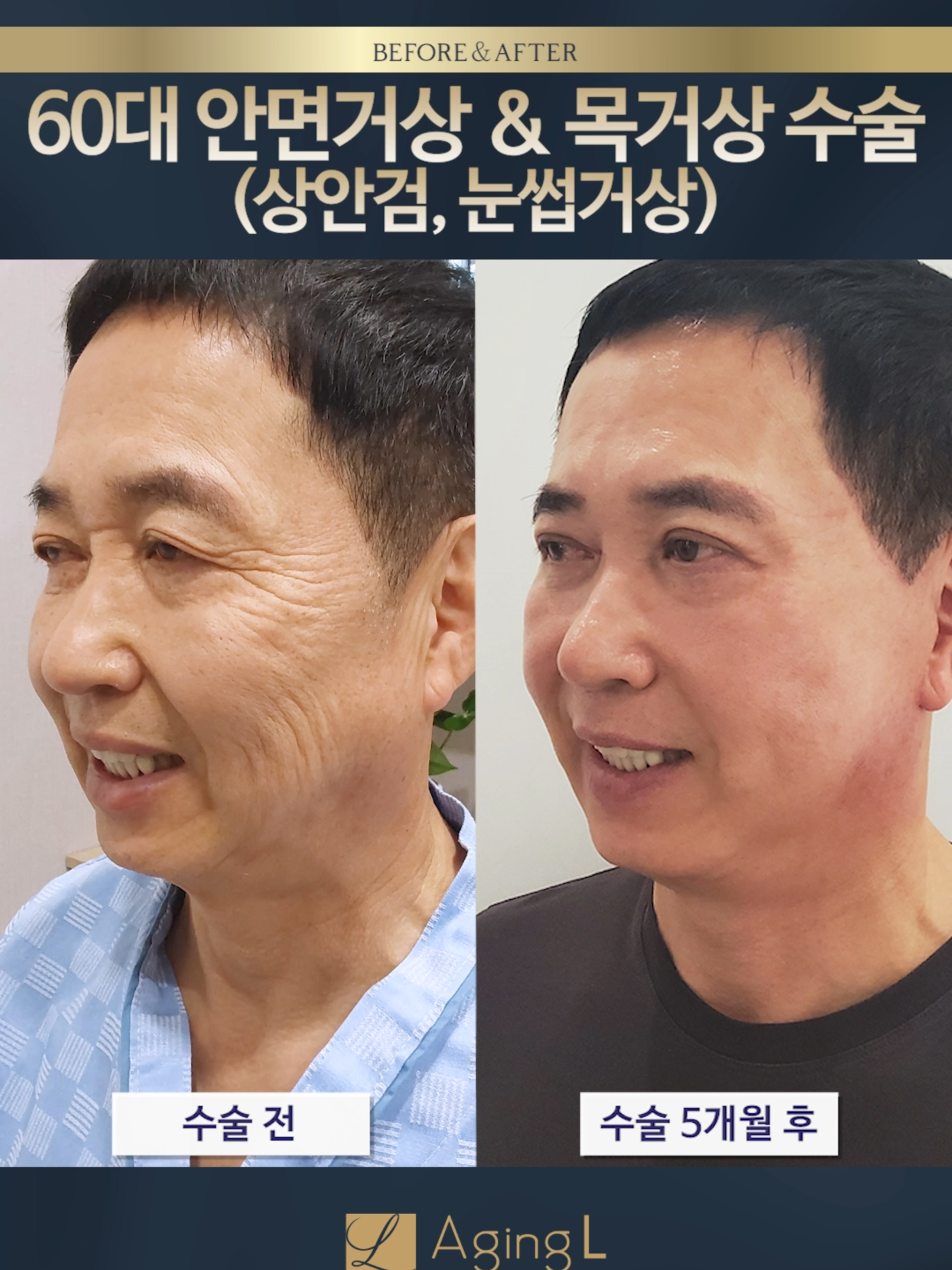 @agingl_official