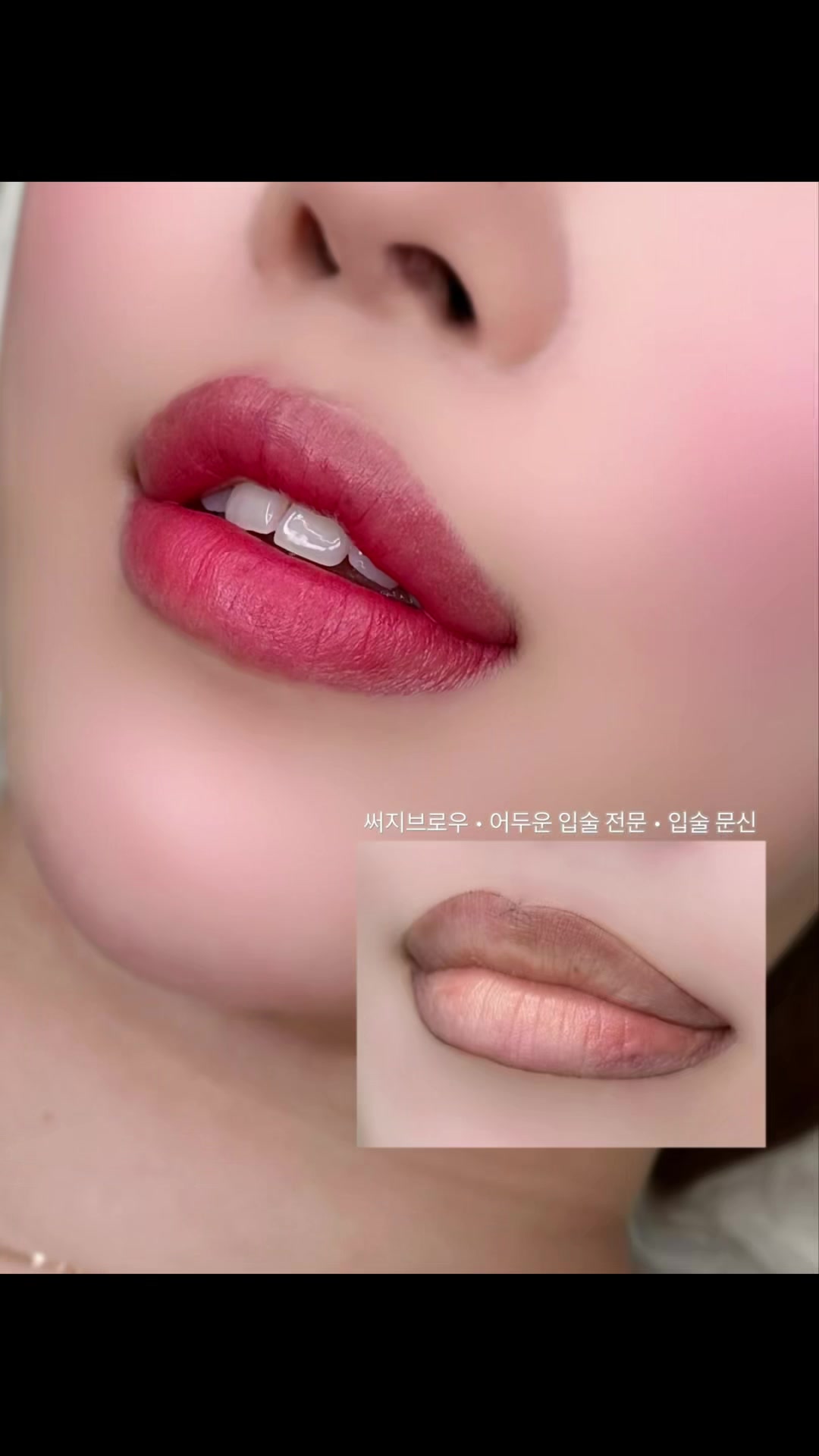@써지브로우 surgebrow