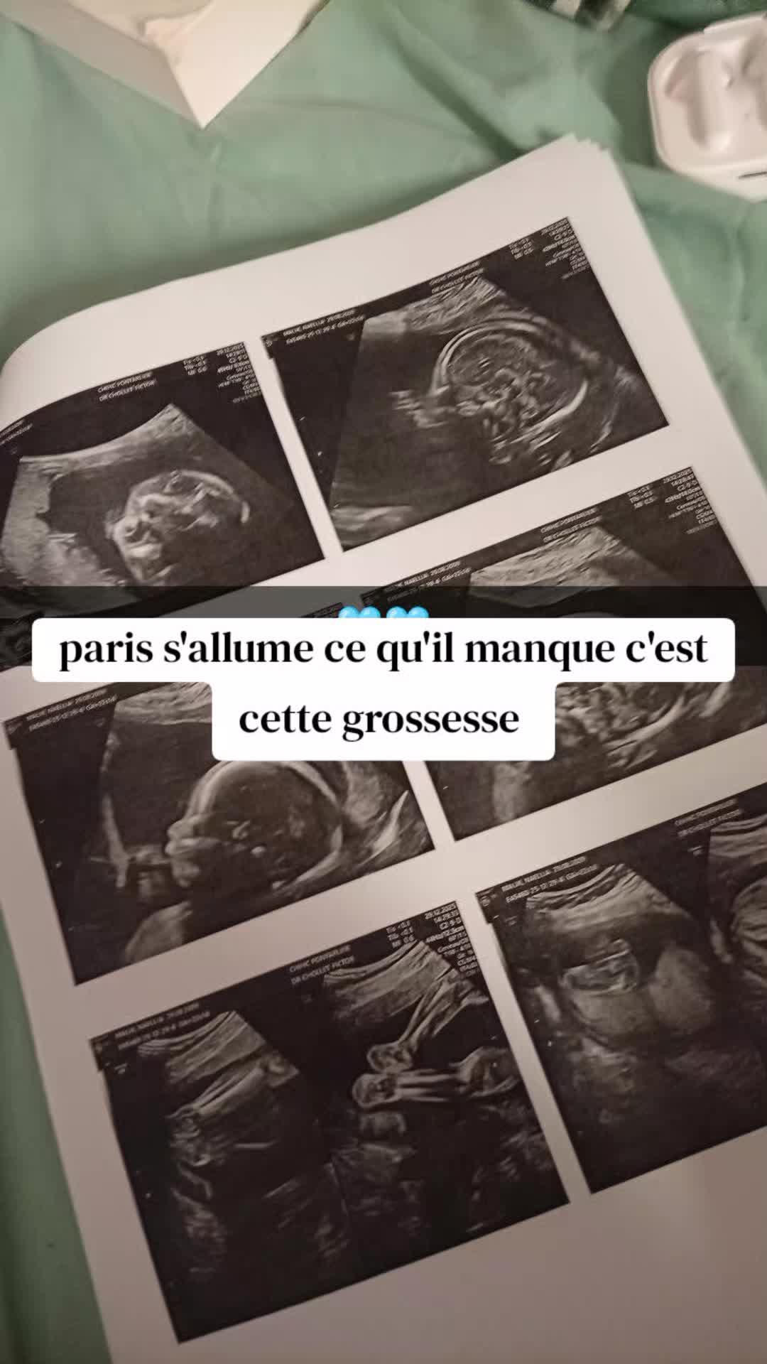 @𝙽aellia 👣🤱🏼🍀