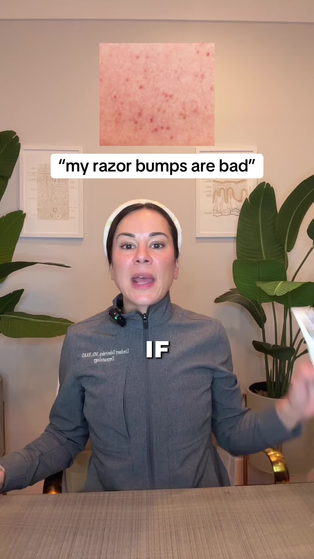 @Dermguru