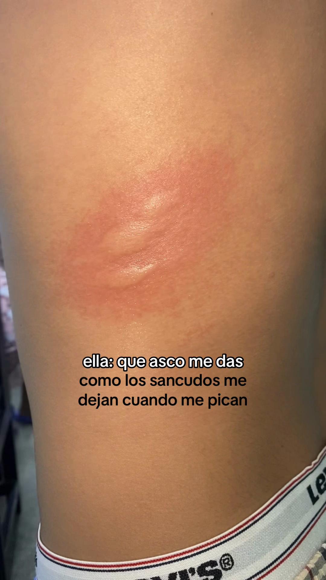 @eguita💘
