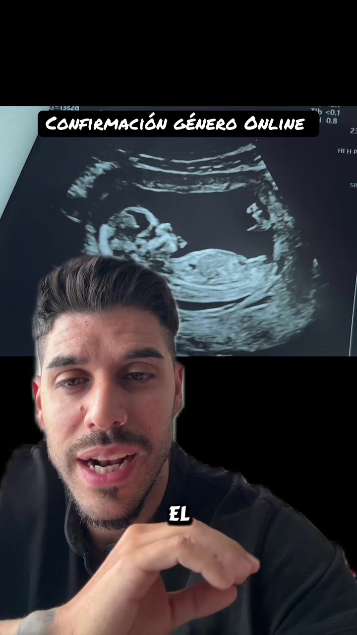 @Abel Pérez