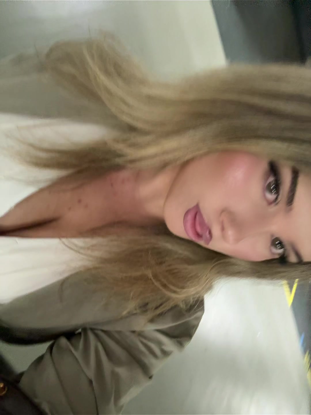 @Albinams