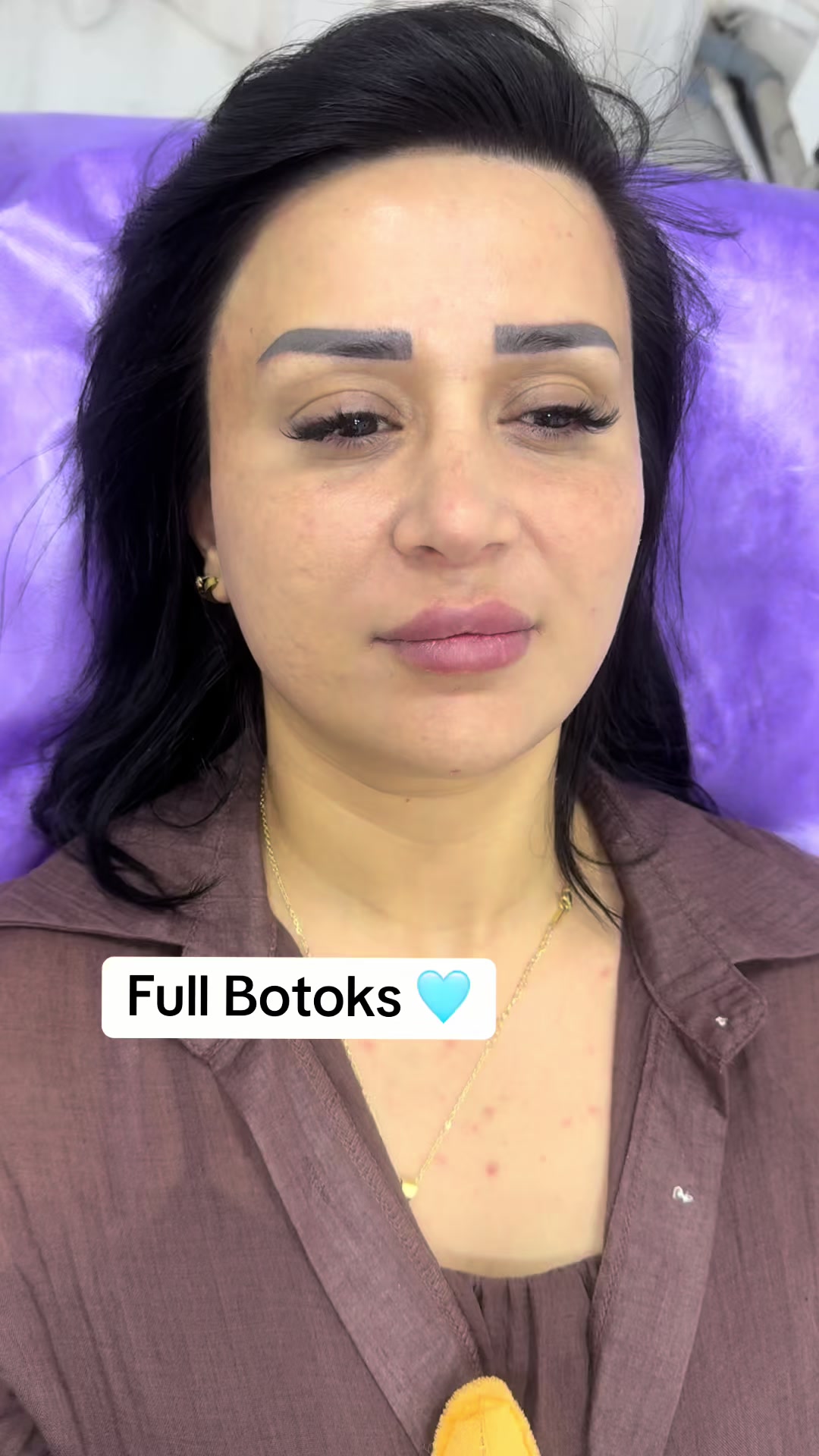 @Kosmetoloq_Gülü_Rajab
