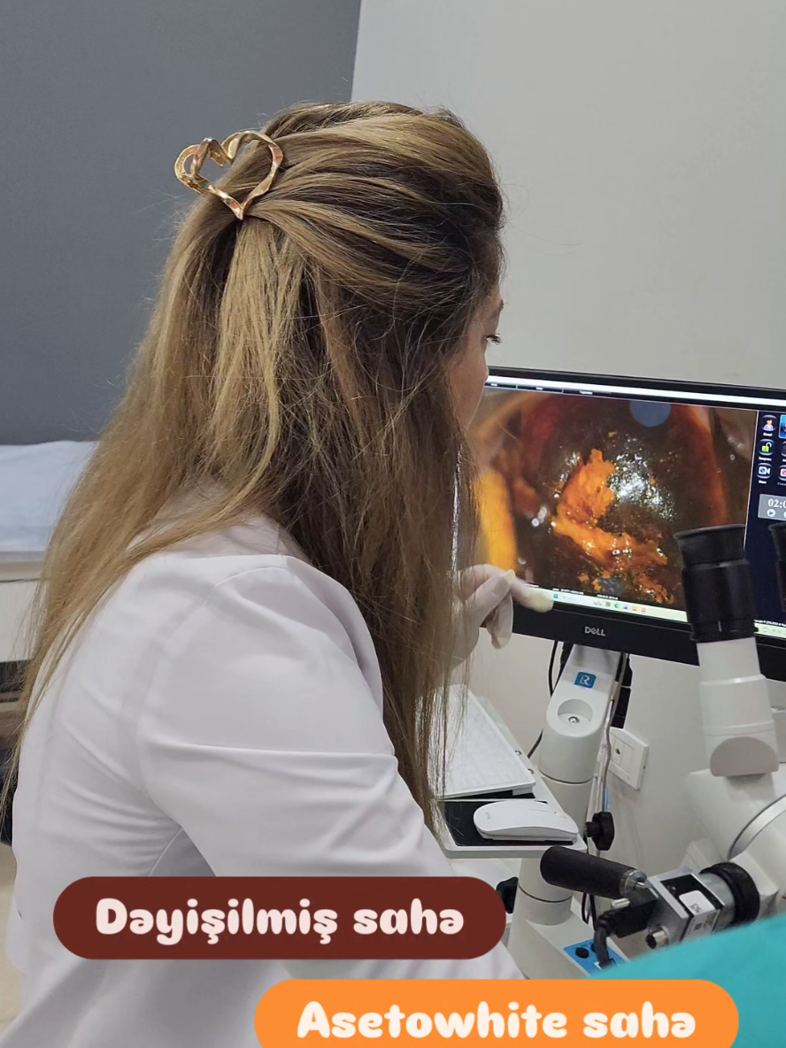 @Ginekoloq Esmira Hasanova