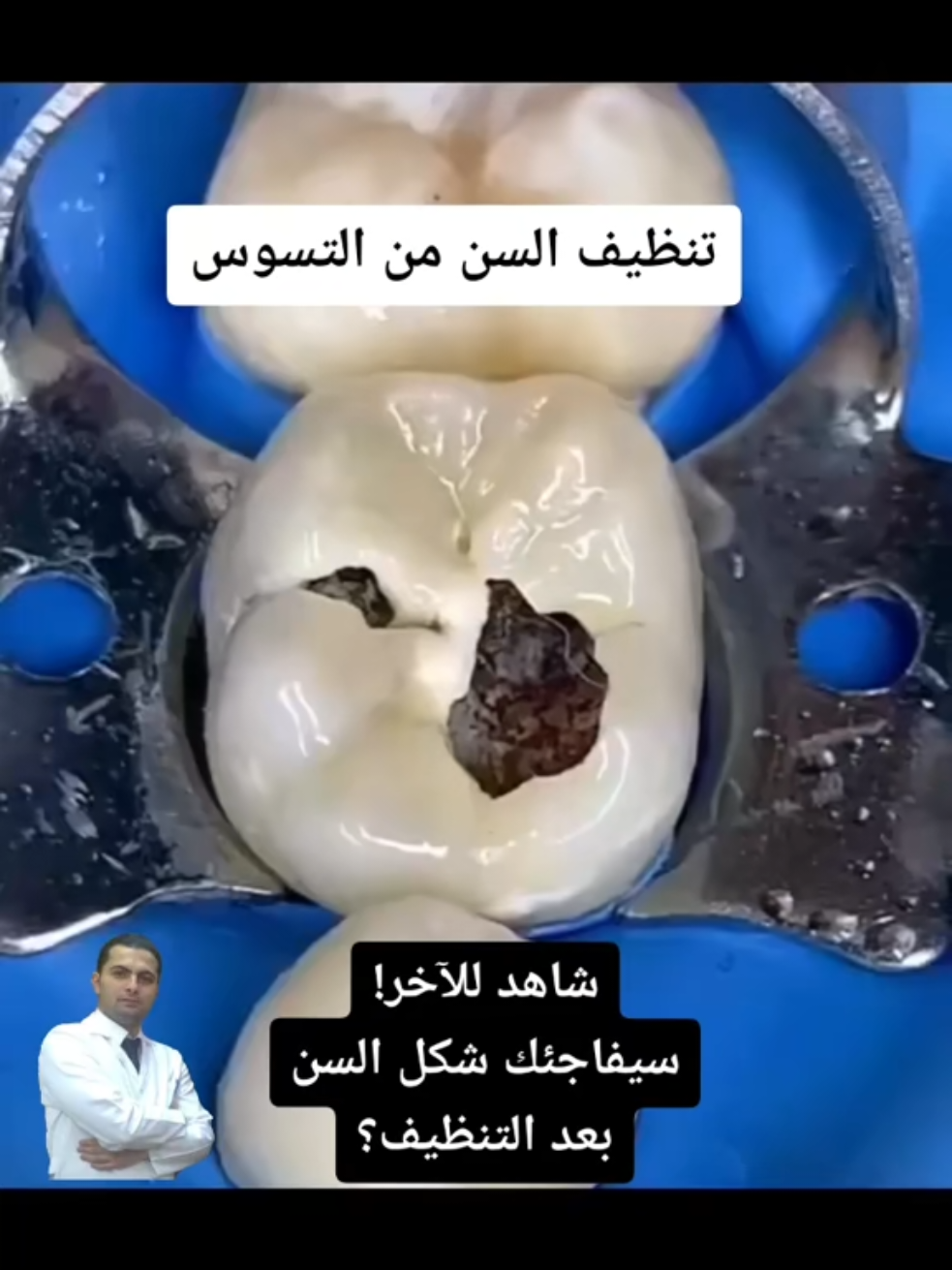 @Samer Akkad | Tandl&auml;kare