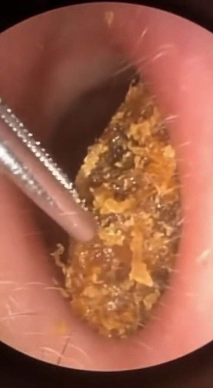 @Ear Cleaning