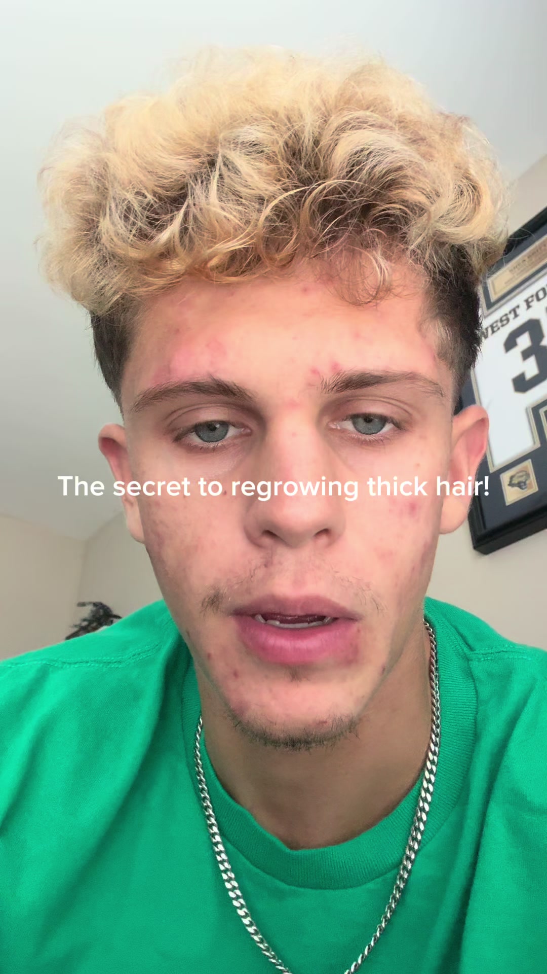 @Trace🎗️